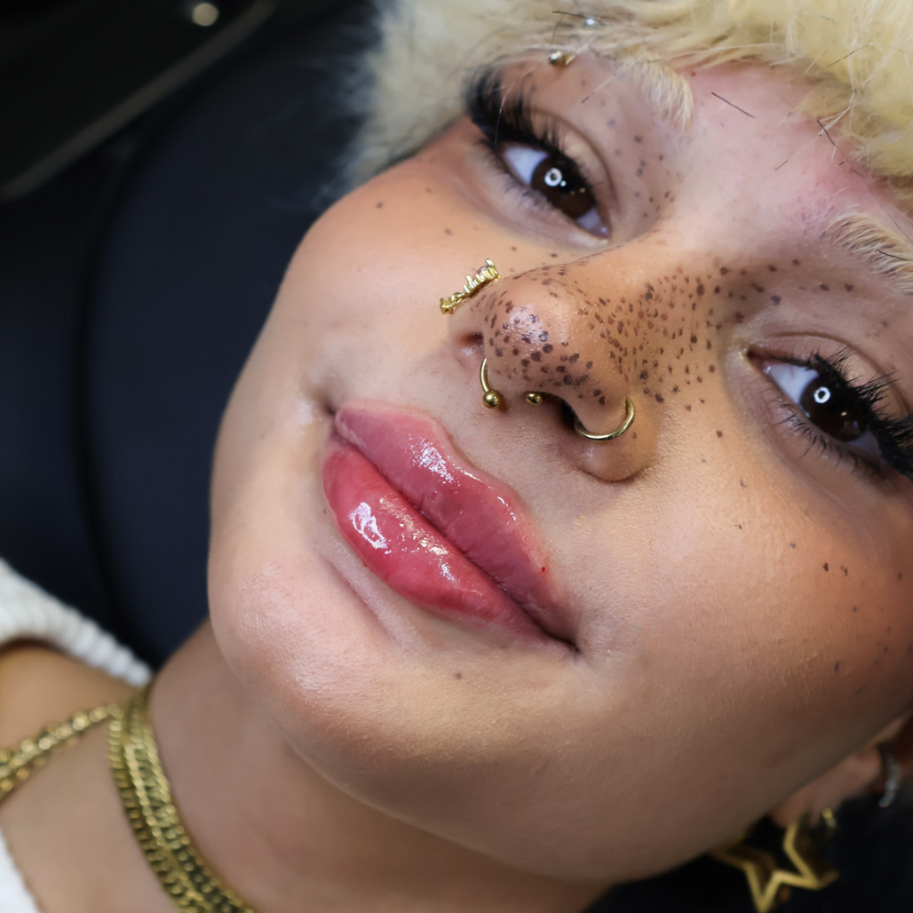 Lippen Ergebnis (1)
