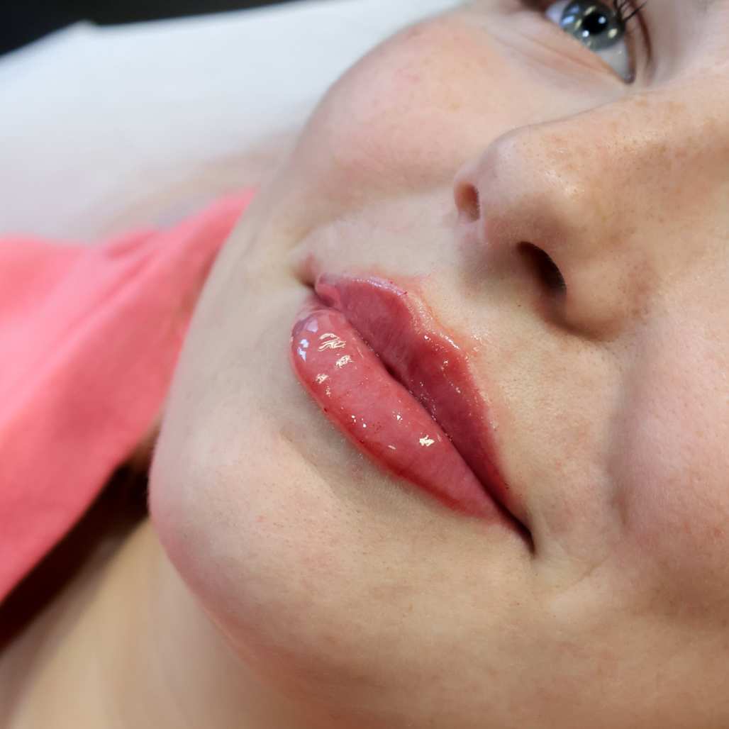 Lippen Ergebnis (4)
